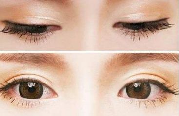 青島壹美天成整形醫(yī)院的隆鼻技術(shù)如何？看看這些真實(shí)案例！