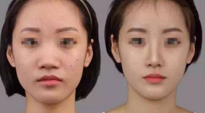 韓國(guó)整形醫(yī)院排行榜公布，精選知名品牌推薦