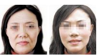 上海九院植發(fā)醫(yī)生口碑榜，收費(fèi)價(jià)格表公開(kāi)