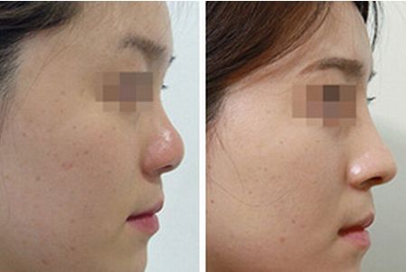 德陽有哪些靠譜的去妊娠紋的醫(yī)院？