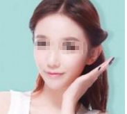 首屈一指的北京瘦身?？漆t(yī)院排行榜
