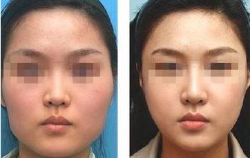南通瘦身整形醫(yī)院哪家專業(yè)？