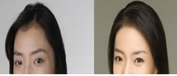 成都悅己醫(yī)美醫(yī)生實(shí)力強(qiáng)，顧客口碑好價格合適
