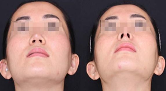 蘭州經(jīng)驗豐富的脂肪豐胸醫(yī)生推薦：逯巖、郭曉磊、雷蓓