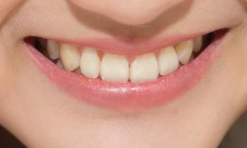 韓國腰腹環(huán)吸哪里好？必當歸、Qline、夢想吸脂瘦腰腹推薦