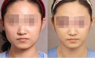 湛江有哪些頂尖整形美容醫(yī)院值得關(guān)注？