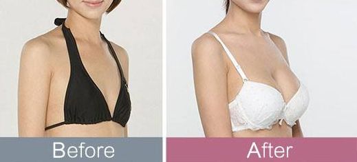 東莞哪家整形醫(yī)院頗受推薦？