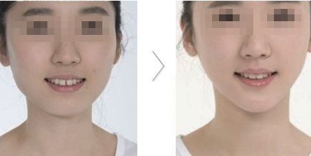 哪家醫(yī)院在北京具有卓越的醫(yī)美科技和服務？歐洲醫(yī)學中心、北京協(xié)和、北大人民醫(yī)院等公立單位有何特色？