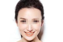 廈門注射隆鼻醫(yī)院優(yōu)質匯總
