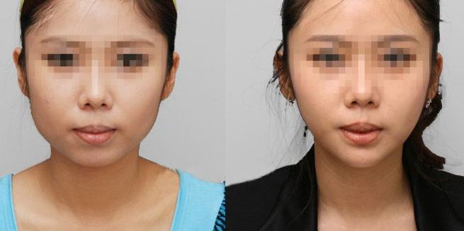 蘭州哪家整形醫(yī)院口碑好？看看排名榜單！