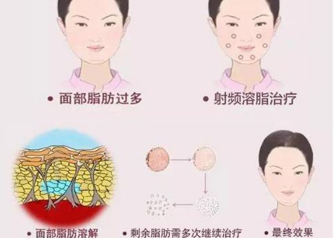徐州二院整形美容科專家評價及服務(wù)項目介紹，陶常波醫(yī)生特長領(lǐng)域一覽