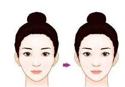深圳哪家醫(yī)院的隆鼻效果好？醫(yī)生口碑怎么樣？