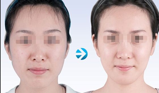 溫州有哪些專業(yè)的鼻子整形醫(yī)院值得推薦？趨勢是怎樣的？