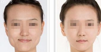 黑龍江三甲整形醫(yī)院熱門榜單，前三強大揭秘！