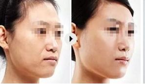 上海頂尖美容整形醫(yī)院精選，讓你真正了解排行榜