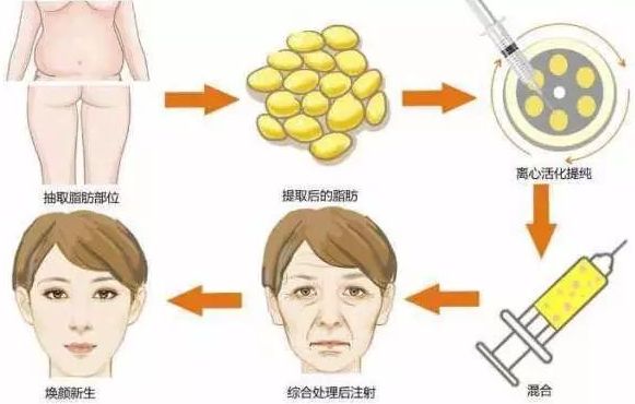 臺(tái)州哪家整形美容醫(yī)院效果好？