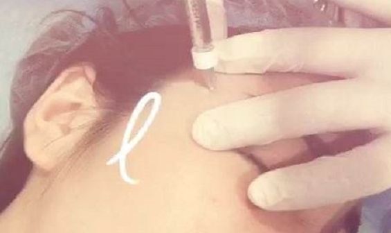 華中科技大學(xué)同濟醫(yī)院整形科科室詳解及整形項目指南