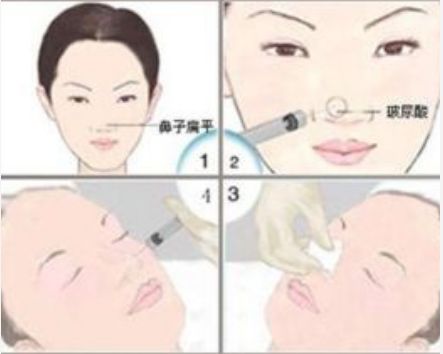 邯鄲維多利亞美容醫(yī)院體驗全解析:門診介紹及價格指南 邯鄲維多利亞美容醫(yī)院體驗全解析:門診介紹及價格指南