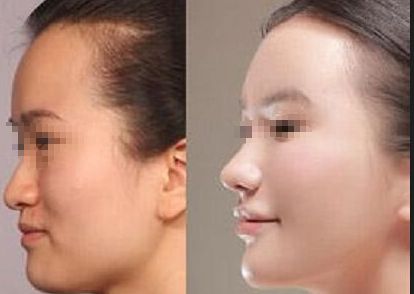 臨沂市醫(yī)美醫(yī)院排名及推薦，推薦你去哪家治療效果好