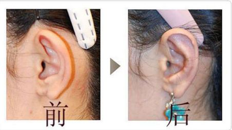 成都友誼醫(yī)院疤痕科：設(shè)備先進(jìn)、技術(shù)精湛，治療效果如何？