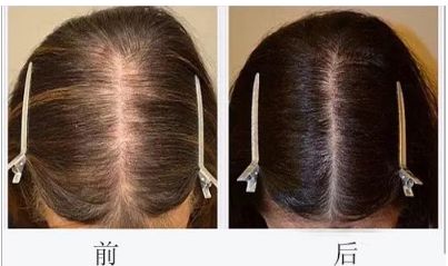 上海頦裂治療?？漆t(yī)院排名出爐，這家醫(yī)院獲得認(rèn)可，其他哪些醫(yī)院也在其中？