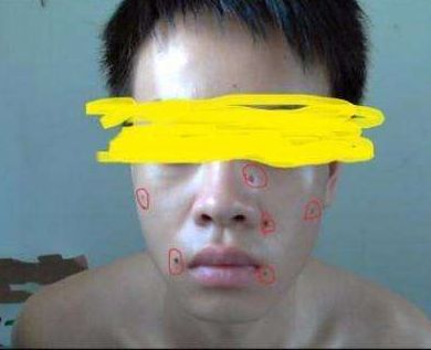 ?？谑笳吾t(yī)院匯總，哪家效果比較好？