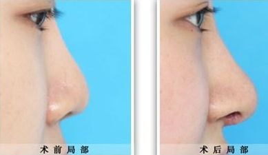 臨汾臻容醫(yī)療美容門診部詳解：技術(shù)水平、服務(wù)項(xiàng)目與價(jià)格清單