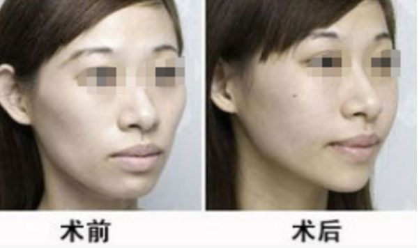 湖北地區(qū)整形醫(yī)院評(píng)選榜單，醫(yī)術(shù)高超排名靠前的醫(yī)療機(jī)構(gòu)
