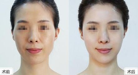 深圳美萊整形醫(yī)院位置介紹，牽手醫(yī)生，搶先體驗(yàn)熱門(mén)項(xiàng)目