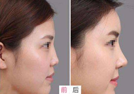 相山愛(ài)美爾醫(yī)療美容門(mén)診部，多項(xiàng)特色項(xiàng)目亮相，幫助您煥發(fā)美麗