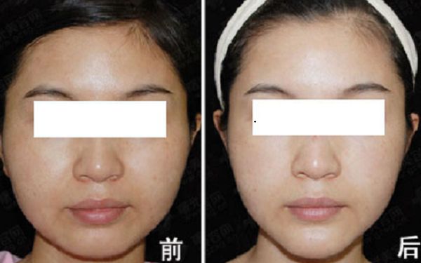 重慶市知名整形美容醫(yī)院榜單出爐！引領(lǐng)時尚潮流的醫(yī)療機構(gòu)盤點