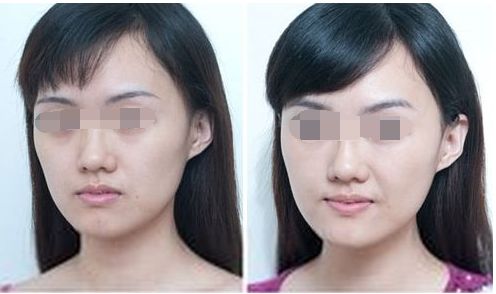 中山整形醫(yī)院八強(qiáng)名單公開！看看這些優(yōu)質(zhì)醫(yī)院是否入選受關(guān)注！