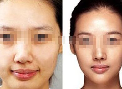 女星蠟像面容成災(zāi)，孫菲菲領(lǐng)銜瘦臉狂潮