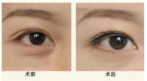 寧波市南湖區(qū)醫(yī)療美容知名醫(yī)院推薦，專(zhuān)家供您選擇