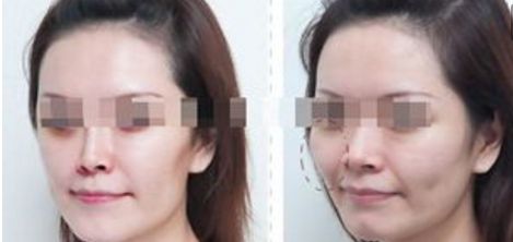 杭州整形美容醫(yī)院排名前六，你值得了解的每一家！