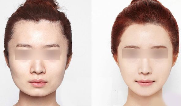 西安藝星醫(yī)療美容醫(yī)院2023年價格一覽：了解醫(yī)療美容服務費用信息，醫(yī)生簡介待查！