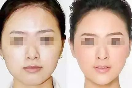 在廣東，如何選擇心儀的醫(yī)美機(jī)構(gòu)？（附醫(yī)院推薦）