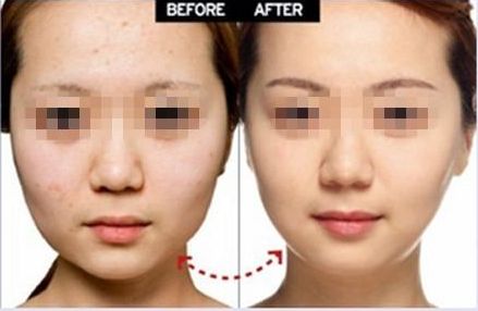 上海眼部整形醫(yī)院推薦，雙眼皮修復(fù)效果好