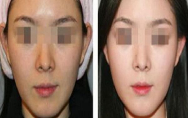 銅陵博愛醫(yī)院醫(yī)療美容科，專業(yè)醫(yī)生技術如何？