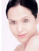 廣州哪家醫(yī)院吸脂做得好？看看排名前十的正規(guī)醫(yī)院