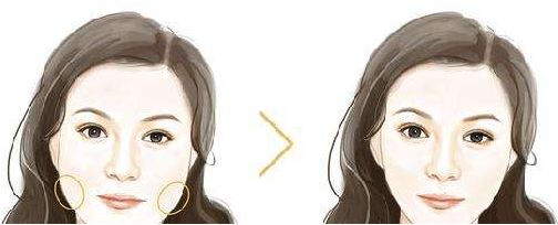 佛山生命加整形美容價格大揭秘，張春光元氣美狐眼等你了解