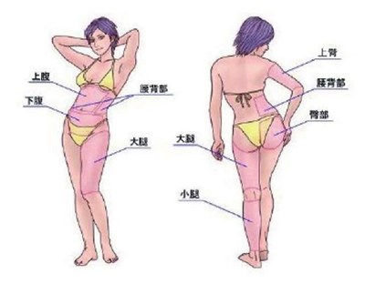武漢光纖溶脂祛動態(tài)細紋醫(yī)生