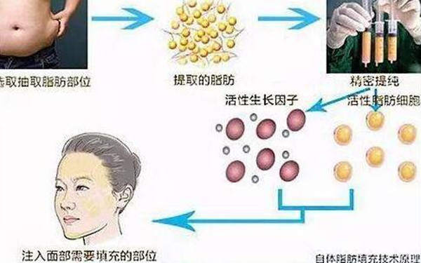 2023年廣州紋身醫(yī)院排名前六、值得關(guān)注的攻略！尤為驚人：公立機構(gòu)包攬前五名