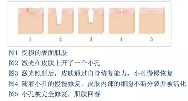 樂山整形美容院推薦！想在樂山做整形的話，這些建議不容錯過！