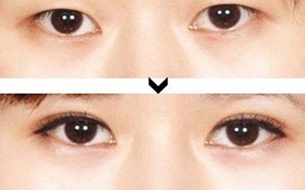 《青島哪家整形醫(yī)院的隆胸醫(yī)生口碑最好？匯總7位頂尖醫(yī)生！》
