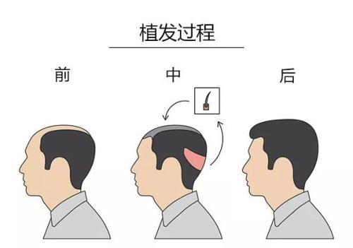 【獨(dú)家】年度最佳整形醫(yī)院盤點(diǎn)！2023連續(xù)六年蟬聯(lián)冠軍，匠心品質(zhì)贏得無(wú)數(shù)口碑推薦！