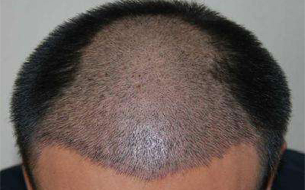 合肥眼袋手術(shù)醫(yī)院盤點(diǎn)，最具信賴的前五名現(xiàn)已公布！壹加壹榮登第三，藝星實(shí)力卓越，穩(wěn)居榜首位置！