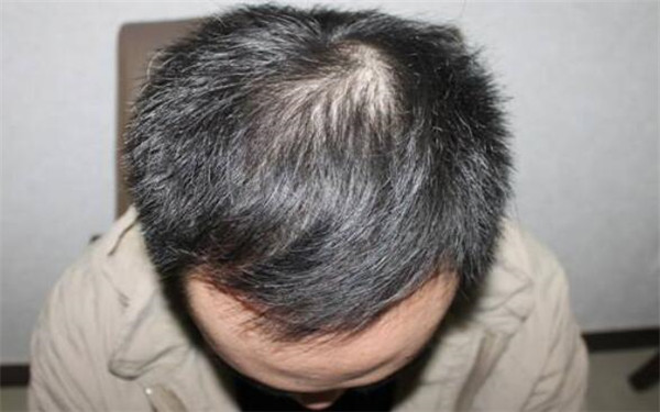 南昌三甲醫(yī)院全面盤點：專業(yè)美容整形醫(yī)院推薦，趕緊了解一下！