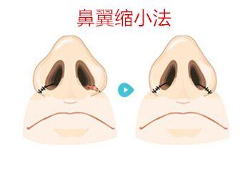 北京十大優(yōu)質(zhì)口腔醫(yī)院推薦，佳美第三醫(yī)院備受贊譽！中諾榜之精選參考