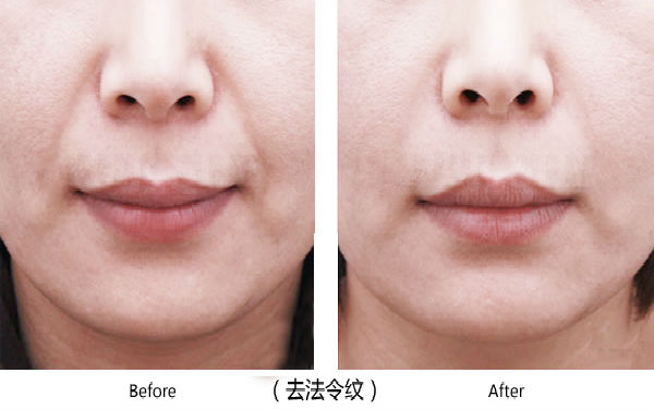 寶雞整容醫(yī)院大整頂級優(yōu)質(zhì)匯總！高一生對決愛容妍_絕對實力的對比震撼